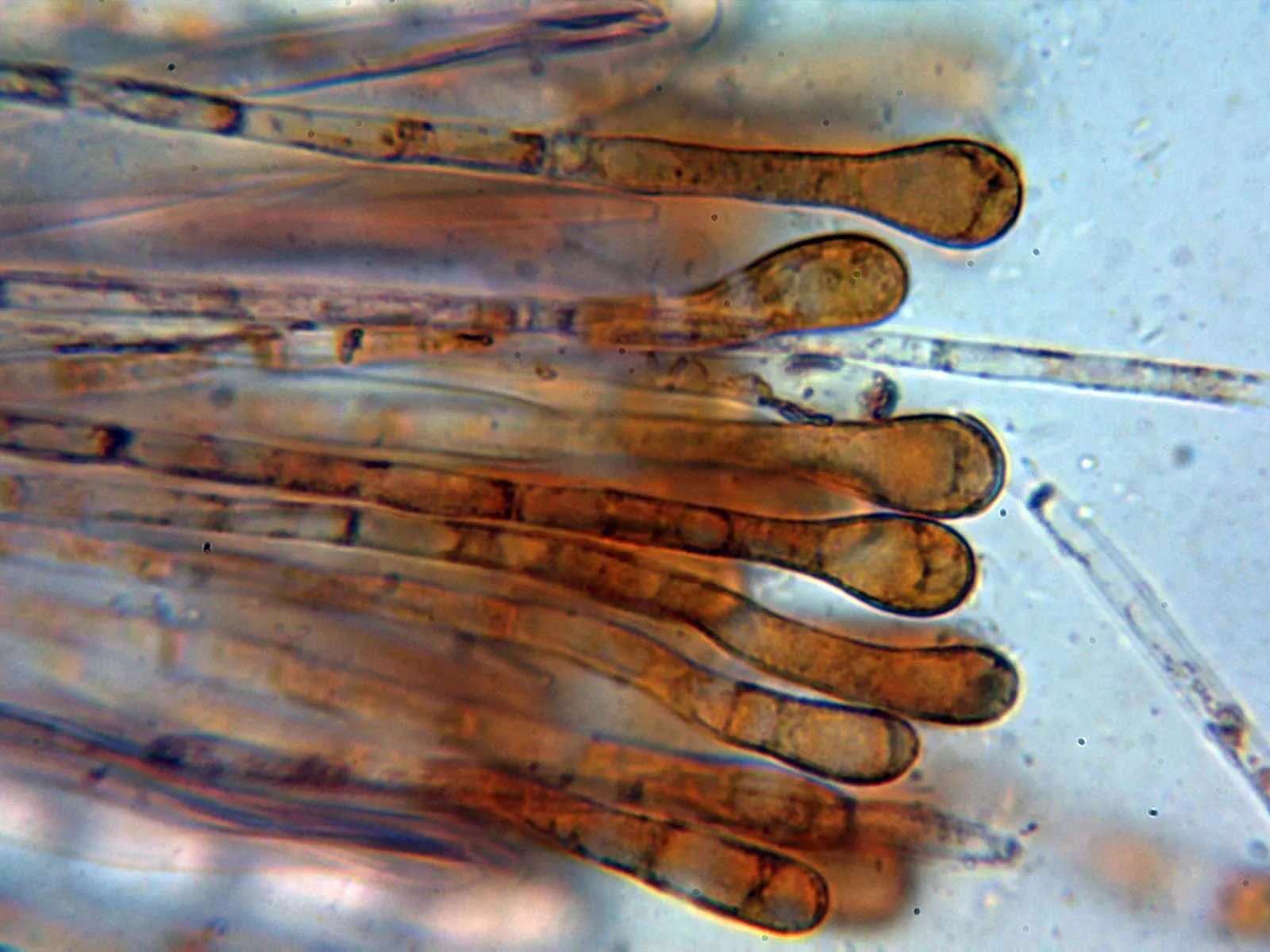 Microscopía de Melastiza chateri - 10 - Paráfisis 1